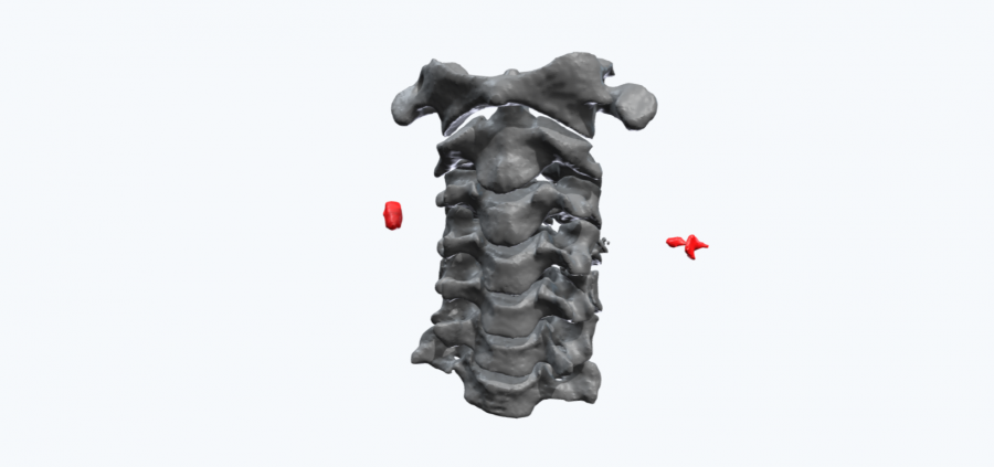 3D printed cervical spine
