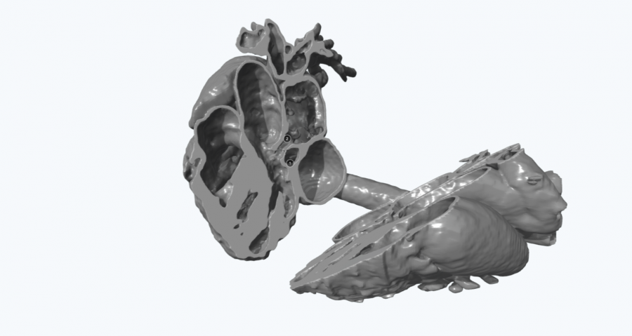 Anatomical 3D model of a new-born baby’s heart