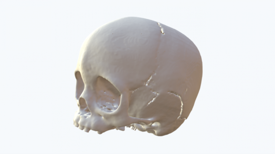 Medical 3D model for skull