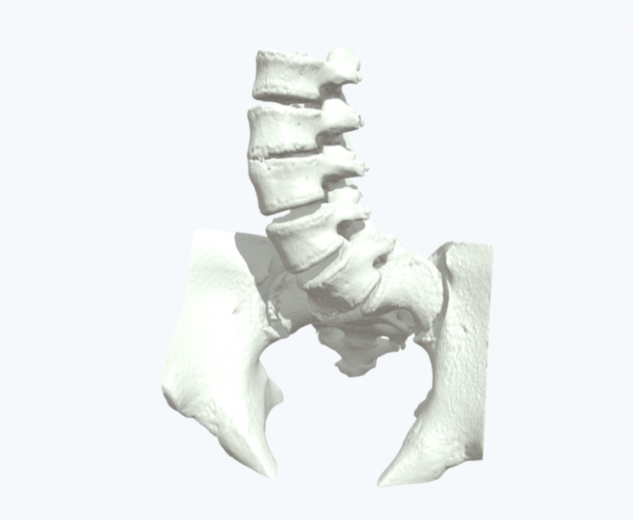 Anatomical model of Patient’s lumbar spine and pelvis