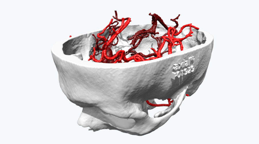 Skull Anatomical model