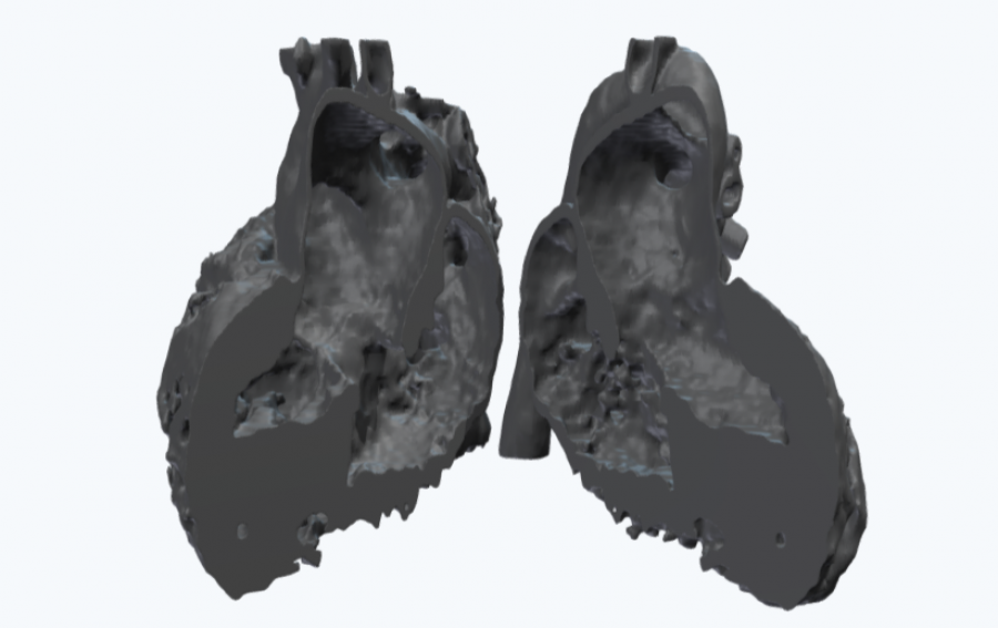 Anatomical 3D heart