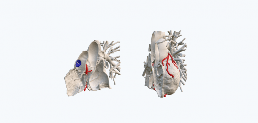 Open Anatomical Heart