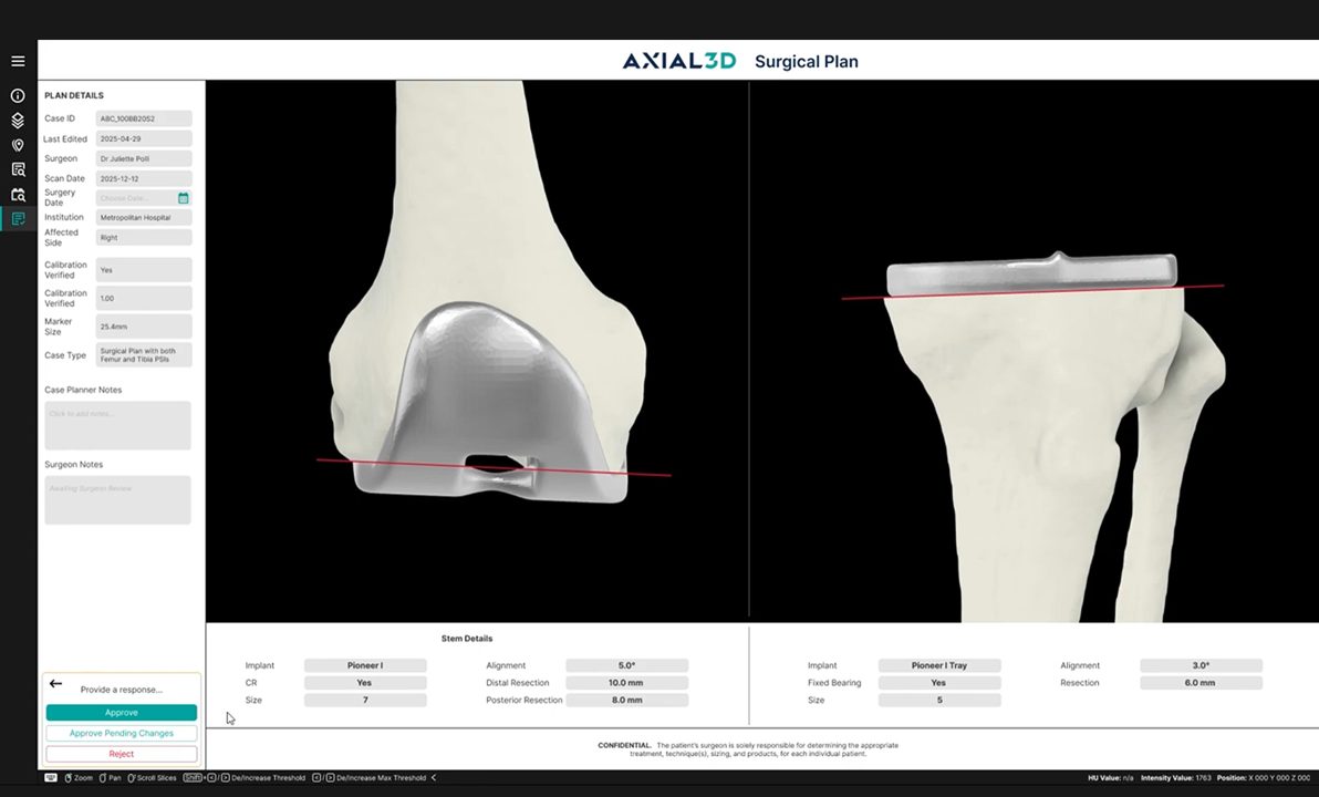 Pre-Surgical and Intra-Operative Planning