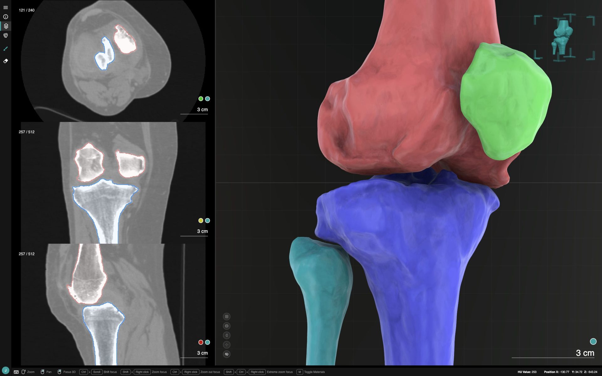 Robotic Planning and Navigation