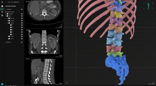 Axial3D AXCEL-Spine