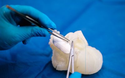 Axial3D_surgical_simulation_3Dmodel