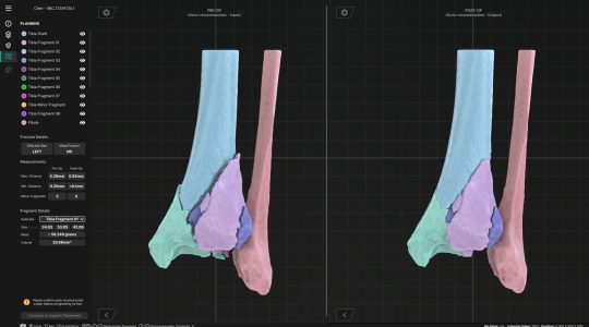 Trauma Planning